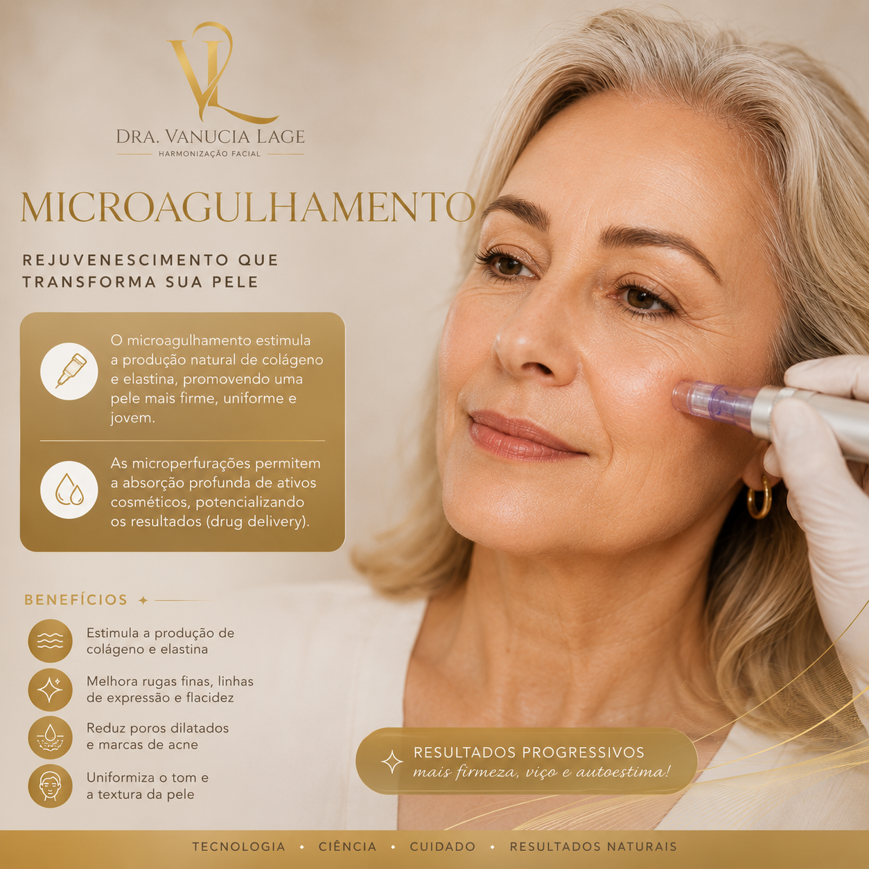 Microagulhamento