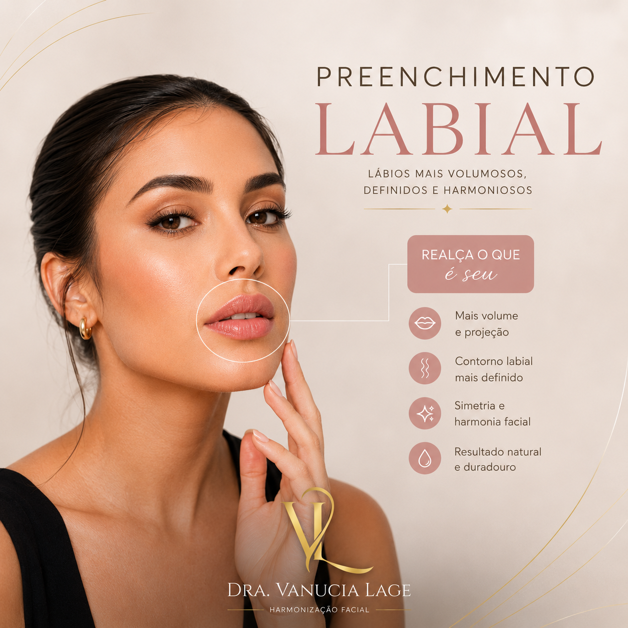 Preenchimento Labial
