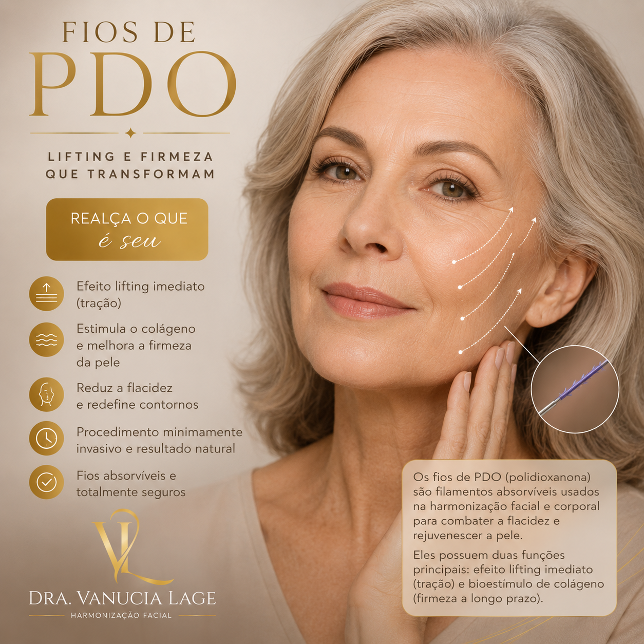 Procedimento de Fios de PDO — Dra. Vanucia Lage