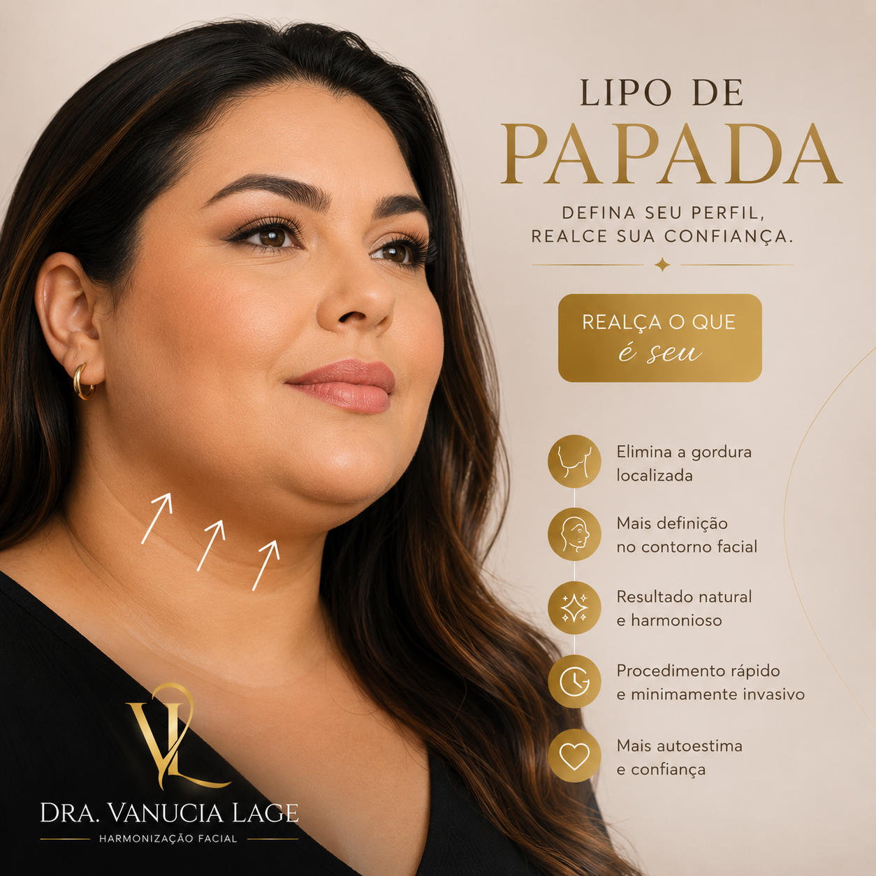 Procedimento de Lipo de Papada — Dra. Vanucia Lage