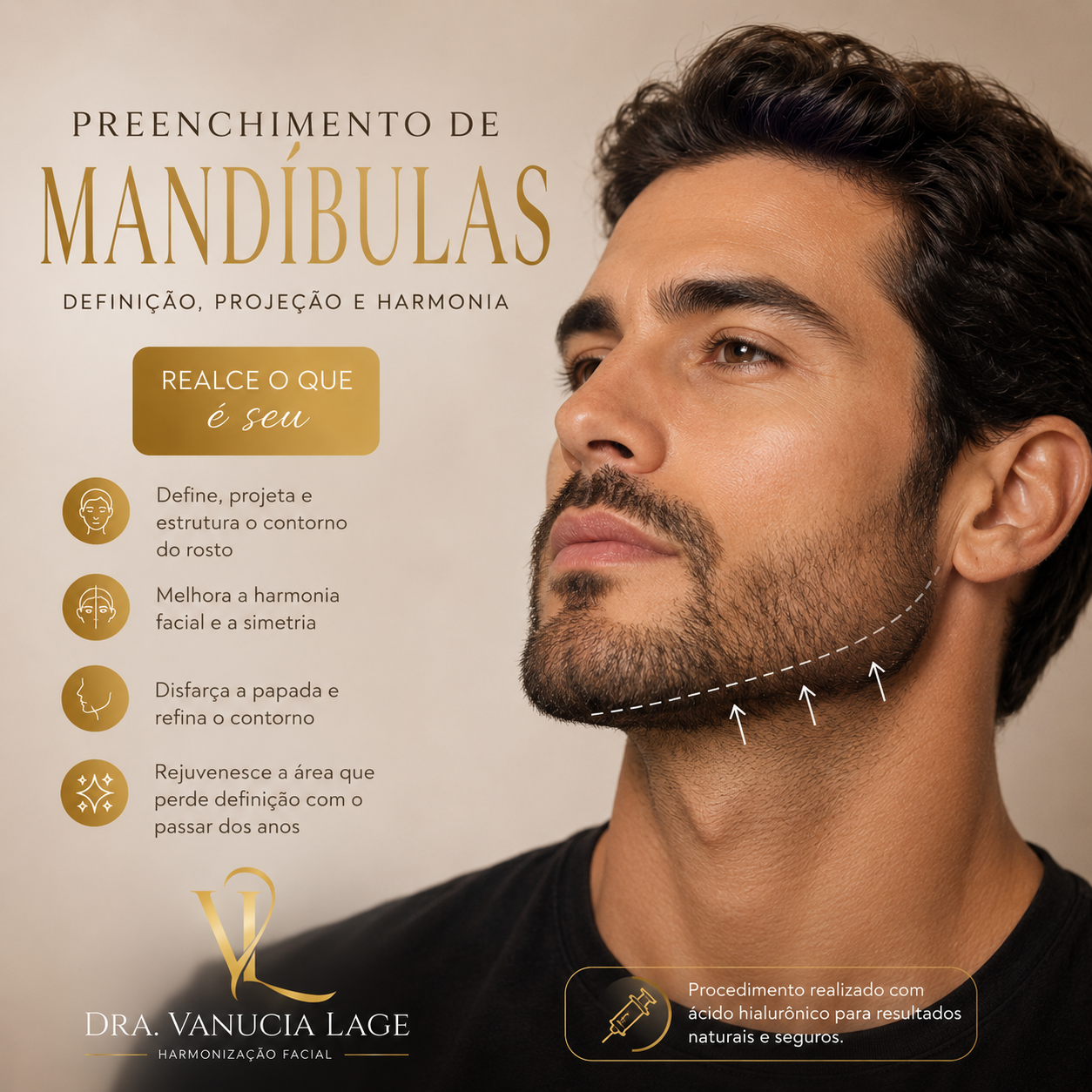 Procedimento de Preenchimento de Mandíbula — Dra. Vanucia Lage